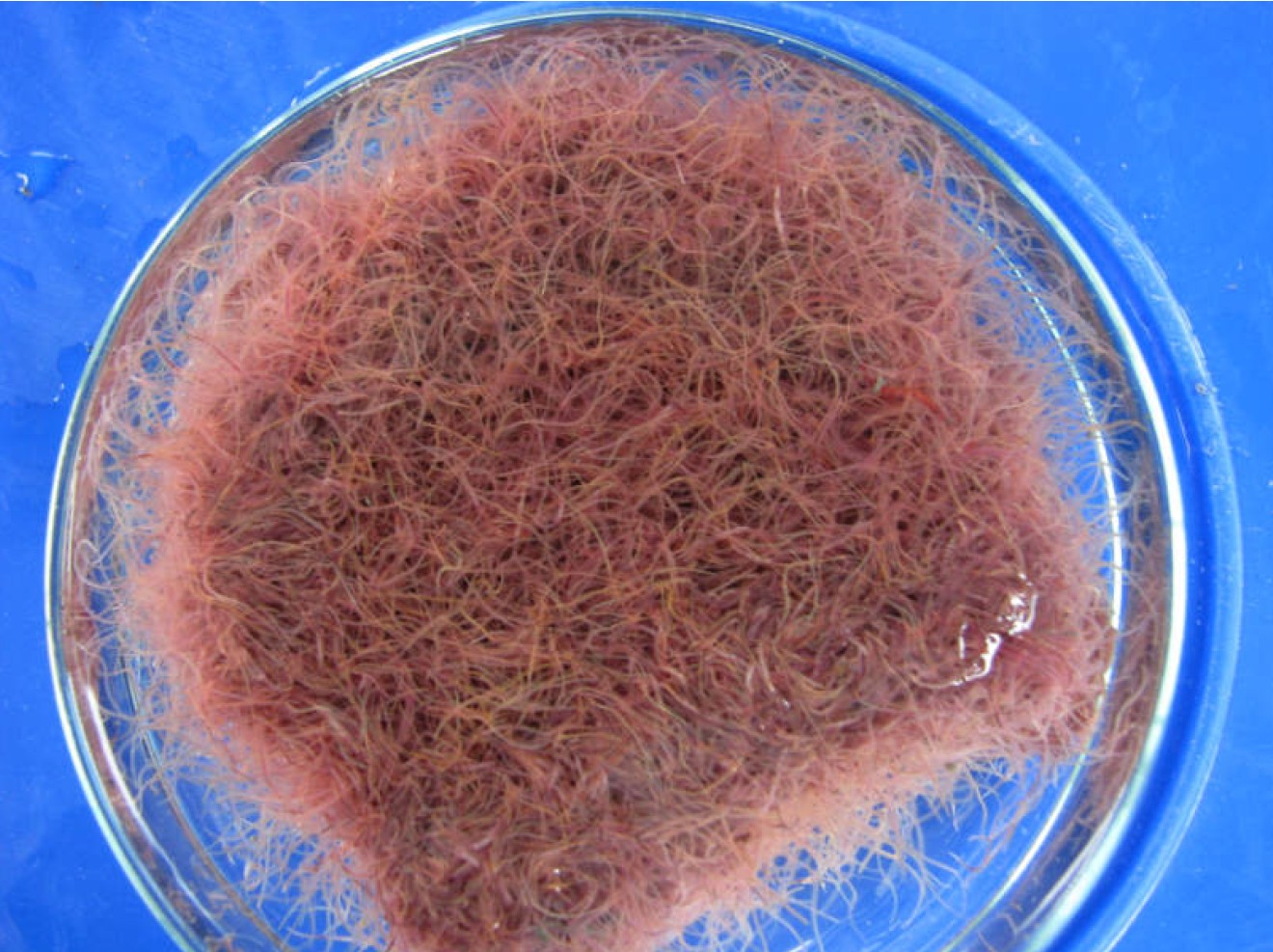 Tubifex in a petri dish